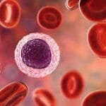 Blood cancer