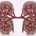 renal cell carcinoma